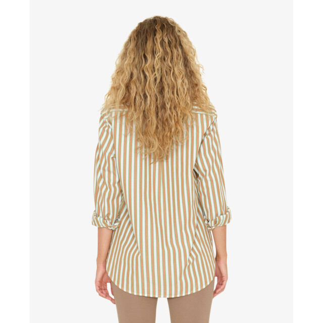 Xirena Blouses & tunieken beau stripe 80017193 large