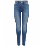 Only Jeans 15239060